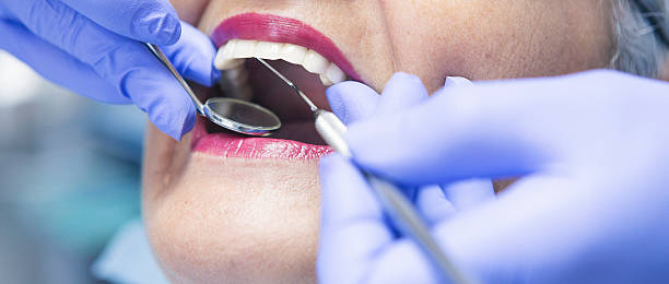 Best Broken or Chipped Tooth Repair in Mission, KS
